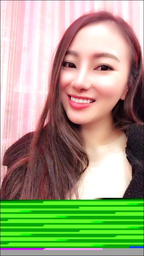 ������Ѱ��������ĸ,1987�ڹ㶫��ݸʧɢ,�۾���˫��Ƥ��������ƫ