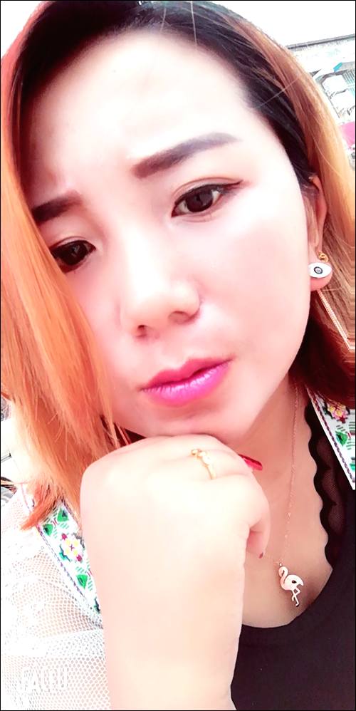 ����ѩ�ҵ��Ľ�,�ڲ�֪����ʧɢ,����˫��Ƥ����ϥ�����и�������