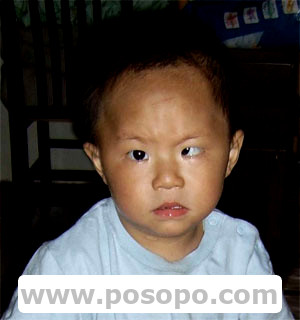 四川倪浩然(迷路走失),眼睛是對眼